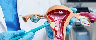 Laparoskopik rahim ve miyom ameliyatı Ankara